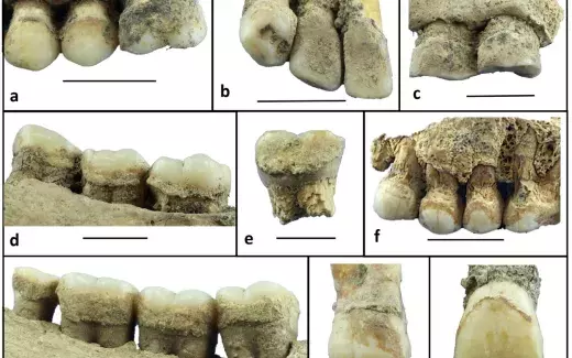 Il tartaro dentale umano rivela nuovi dati sullo sfruttamento delle risorse vegetali nel Sudan orientale antico