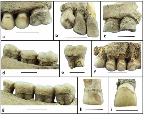 Il tartaro dentale umano rivela nuovi dati sullo sfruttamento delle risorse vegetali nel Sudan orientale antico